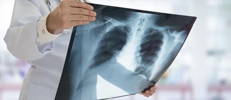 Limited Medical Radiography Certificate